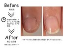 きれいに爪を伸ばしたい方に♪
