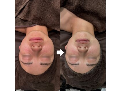 ナナラ(nanala)の写真