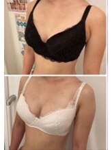 スマイルクルー(SmileClue)/３回の施術と食事改善での変化