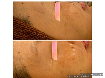 イディアル(IDE'AL)/陶肌トリートメント＋生酵素