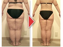 トータルケアハウス エイチ ツー オー ラピス宝塚店/ ビフォーアフター（下半身）