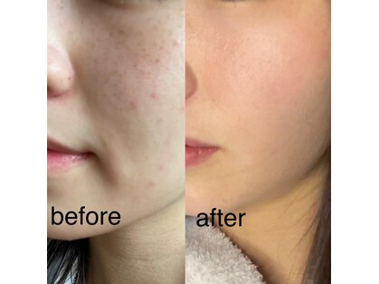フォルトゥーナ ビューティー(Fortuna Beauty)の写真