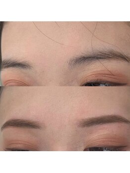 ビュー テンジン 天神 大名(VIEW TENJIN)/アイブロウ（眉毛）WAX脱毛