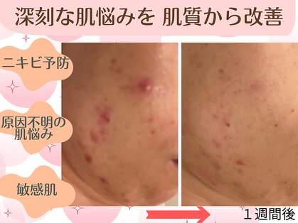 エラフリーの写真