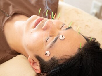 ひなはり灸整骨院の写真/【メンズ歓迎☆】鍼灸で眼精疲労や肩こり・腰痛などのお疲れを癒します♪美容鍼は男性にもおすすめ◎