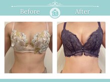 美人バスト 辻堂店/バストアップ★☆症例写真☆★