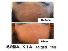 ラナン パラフューズ(Ranun's PARAFUSE.)/男性も肌質改善でイケ肌へ♪