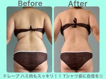 ビーナイス ビューティー(Be Nice Beauty)/今年の猛暑は薄着対策◎
