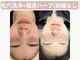 イーラボ 池袋店(e-LABO)の写真/【国産ハーブ使用/純度100%/剥離なし】×【毛穴洗浄/トルネード水流】で即効効果出し！ニキビケア/毛穴汚れ