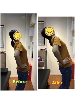 くすの樹接骨院 整体院 吉野ヶ里院/整体/骨盤矯正ビフォーアフター