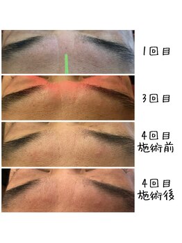 シンシンラボ 豪徳寺(SHINSHIN Lab)/お悩み部位にも的確にアプローチ