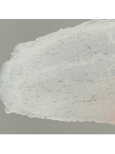 ルブール(levure)/自己処理では難しい