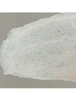 ルブール(levure)/自己処理では難しい