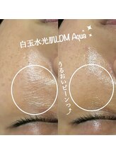 ミヨン(Miyong)/水光肌LDM/アンチプレシオネス