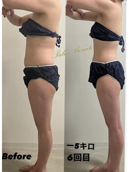 パームボーテ(Palm Beaute)/運動しなくても変化を実感！