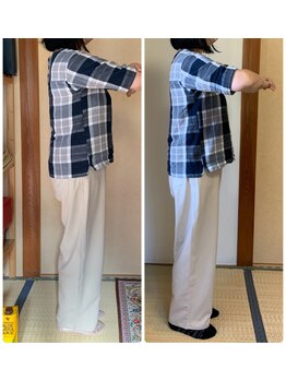 リンドール(RinDoll)/60代女性ダイエット/耳ツボ/痩身