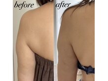 ミセル(MISEL2nd)/キープ力◎リピートNo.1最新痩身