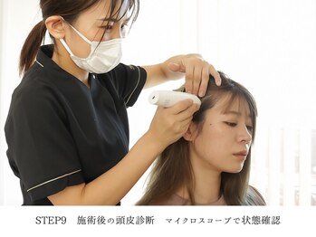 ラ ソワ(la soie)/施術後の頭皮診断