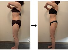 ドクターエイジレス(DR.AGELESS)/食べファスコース/半年