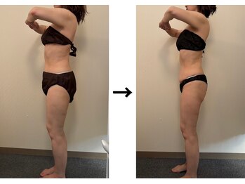 ドクターエイジレス(DR.AGELESS)/食べファスコース/半年