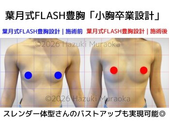 セブンシーズ 上野店(Seven Seas)/豊胸/バストアップ/東京/上野