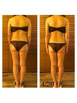 ラナ(LANA)/【痩身】スリムボディ