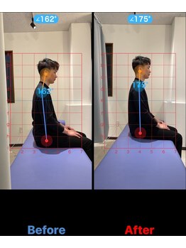 松戸駅前鍼灸院 整骨院/歪み/骨盤矯正/姿勢改善