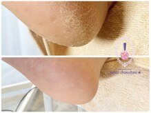 プティ シュシュ(Petite chouchou)の雰囲気(足の角質ケアでひび割れ知らず。歩きやすいふわふわな足元に◎)