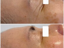 ボディメイキング キキ(Bodymaking KIKI)/目元ふっくらで印象アップ！