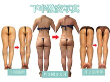 痩せにくい下半身もこんなに変わります