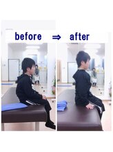 ストレッチヒーロー 広島長楽寺店/ビフォーアフター