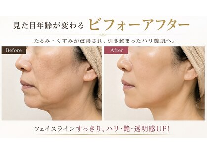 ミニョンボーテ(mignon beaute)の写真