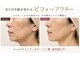 ミニョンボーテ(mignon beaute)の写真