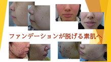 フェイシャルスタイリストサロン 高崎店(Facial Stylist Salon)