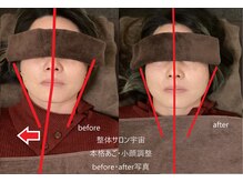 整体サロン宇宙/☆本格あご・小顔矯正☆