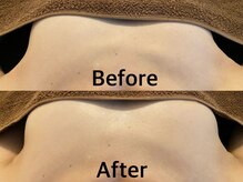 整顔整頭/【左右差】