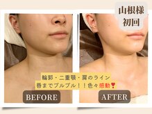 ビューティーサロンエー 心斎橋店(Beauty Salon A)の雰囲気（１回でここまでの変化！！試す価値あります♪心も顔もスッキリ◎）