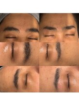 イデアル(ideal)/眉毛WAX脱毛