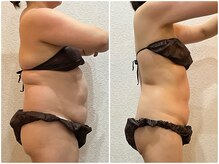 美容整体 ウェリナ 蟹江院/小顔矯正/骨盤矯正/美脚サロン