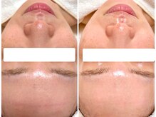 ボディメイキング キキ(Bodymaking KIKI)/自分の肌が好きになる