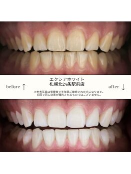 エクシアホワイト 北24条駅前店/