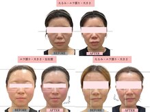 グレースエール トータルビューティーサロン(Grace Aile)の雰囲気（エラ張り・顔の大きさ・左右差）