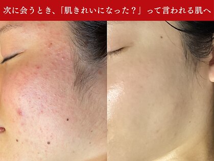 肌レボ 池袋店(肌REVO)の写真