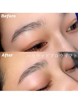 キンキー 広島(kinky)/