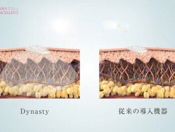 サラエクセレント 心斎橋(SARA EXCELLENT)/バストアップ/バストケア/心斎橋