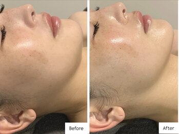 ラグ(LUXU)/小顔にも◎