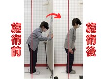 ほねつぎ須屋鍼灸接骨院/姿勢矯正２