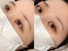 アンバイアオ 本町(UN by ao.)/すっぴん力up◎