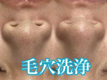 マルサンカクシカク(○△□)/毛穴洗浄