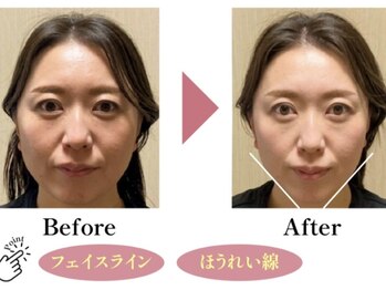 クレーヌ(CREINE)/